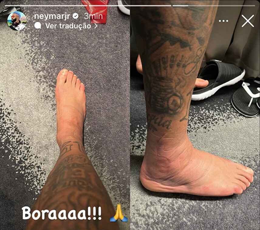 Neymar ayağının son halini paylaştı Görenler şaşkına döndü Futbol