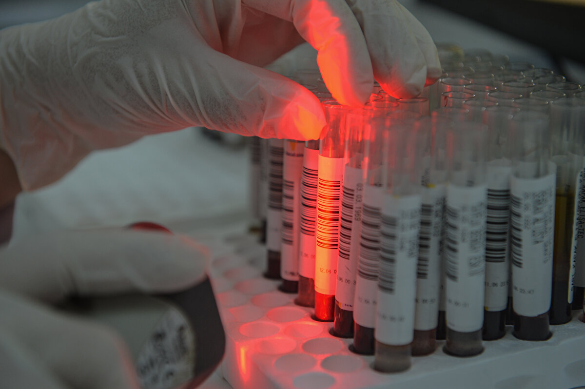 Sancaktepe'de belirlenen hanelerden biri de Tan ailesinin evi. Sancaktepe İlçe Sağlık Müdürlüğü filyasyon ekiplerinin kapısını çaldığı ve test uyguladığı taksi şoförü Hamza Tan (42), antikor tarama çalışmasına dahil edilmekten mutlu olduklarını anlatarak "Çok ağır bir grip geçirmiştim ancak salgının hemen öncesiydi. Acaba koronavirüs geçirdik mi diye eşimin de benim de şüphelerimiz vardı. Sağlık Bakanlığı'nın salgını açıklamasından sonra ben hemen ev değiştirdim ve yaklaşık 3 ay boyunca annem, babam, çocuklarım ve eşimden ayrı bir evde kaldım. Hiç görüşmedik, yaklaşmadık birbirimize, çünkü ben dışarıda çalışıyordum onları riske atmak istemedim. Sonuçta vatandaş olarak böyle bir uygulamadan da mutlu olduk. Sağlık Bakanlığı'nın ilgisi, sağlık çalışanlarımızın ilgisi, bizler için bir güvence oluyor. Hastalığı geçirmişsek bilgimiz olacak, geçirmemişsek de daha tedbirli davranmaya devam edeceğiz anlamına geliyor" diye konuştu. 