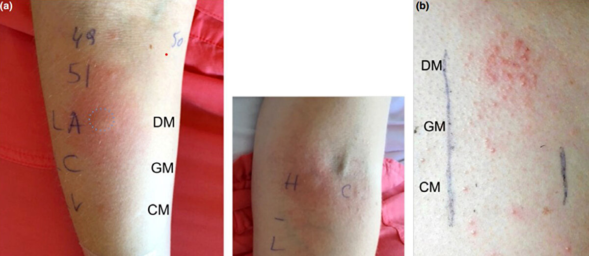 Anne sütüne çok yakın özellikte olduğu iddia edilerek yıllarca eşek çiftliği sahipleri tarafından vatandaşa satılan sütün, yurt dışında bilim insanları tarafından araştırılıp, makalelere konu olduğuna, kesin olarak kanıtlamış bir faydası olmamakla birlikte alerjik reaksiyon gösterebildiğine dikkat çekildi.

