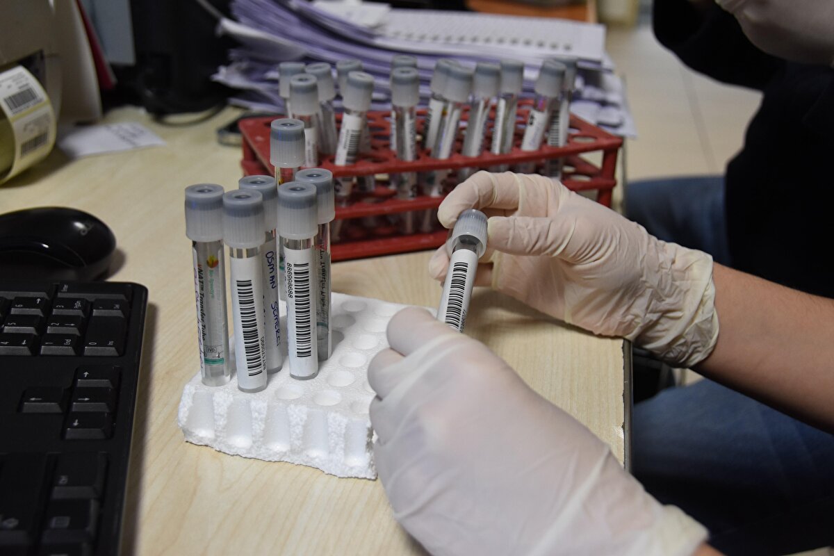 Aynı anda iki cihazla 168 adet testin yapılabildiğini anlatan Uzman Dr. Doğandemir, “O anki yoğunluğa göre iki cihazımızı da kullanabiliyoruz. Sayılar artarsa ki her geçen gün artıyor, her 2 cihazı aynı anda da kullanarak süreyi kısaltabiliriz. Vaka sayılarımız bir dönem oldukça azalmıştı. Bunlar bizi mutlu etmişti fakat son zamanlarda tekrar bir artış yaşıyoruz. Bu tabii ki hastaneye yatış ve ölüm oranları açısından bizi endişelendiriyor. Bizim yoğun çalışmamız bir yana, özellikle vatandaşlarımızın bu hastalıktan etkilenmelerinden endişe ediyoruz. Onlardan kendilerine dikkat etmelerini, kurallara uymalarını rica ediyoruz” şeklinde konuştu.
