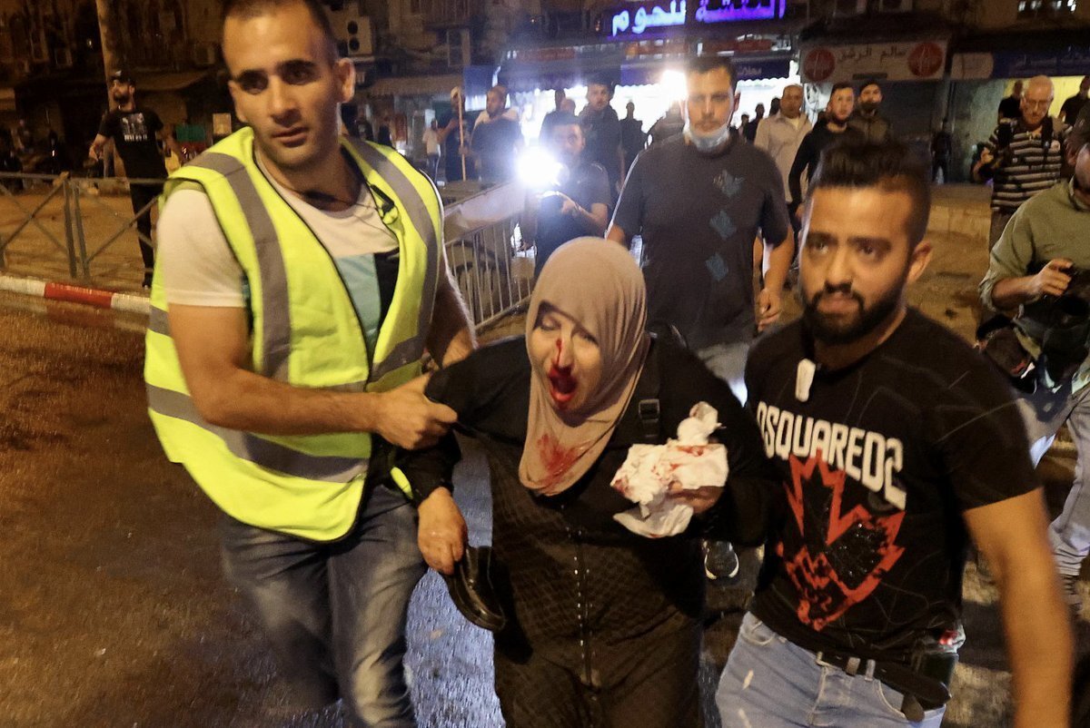 Filistin Kızılayı, İsrail'in saldırılarında 53 Filistinlinin yaralandığını, yaralılardan 6’sının hastaneye kaldırıldığını açıkladı. Yaralıların çoğunun plastik mermi ile vurulduğu bildirildi.  