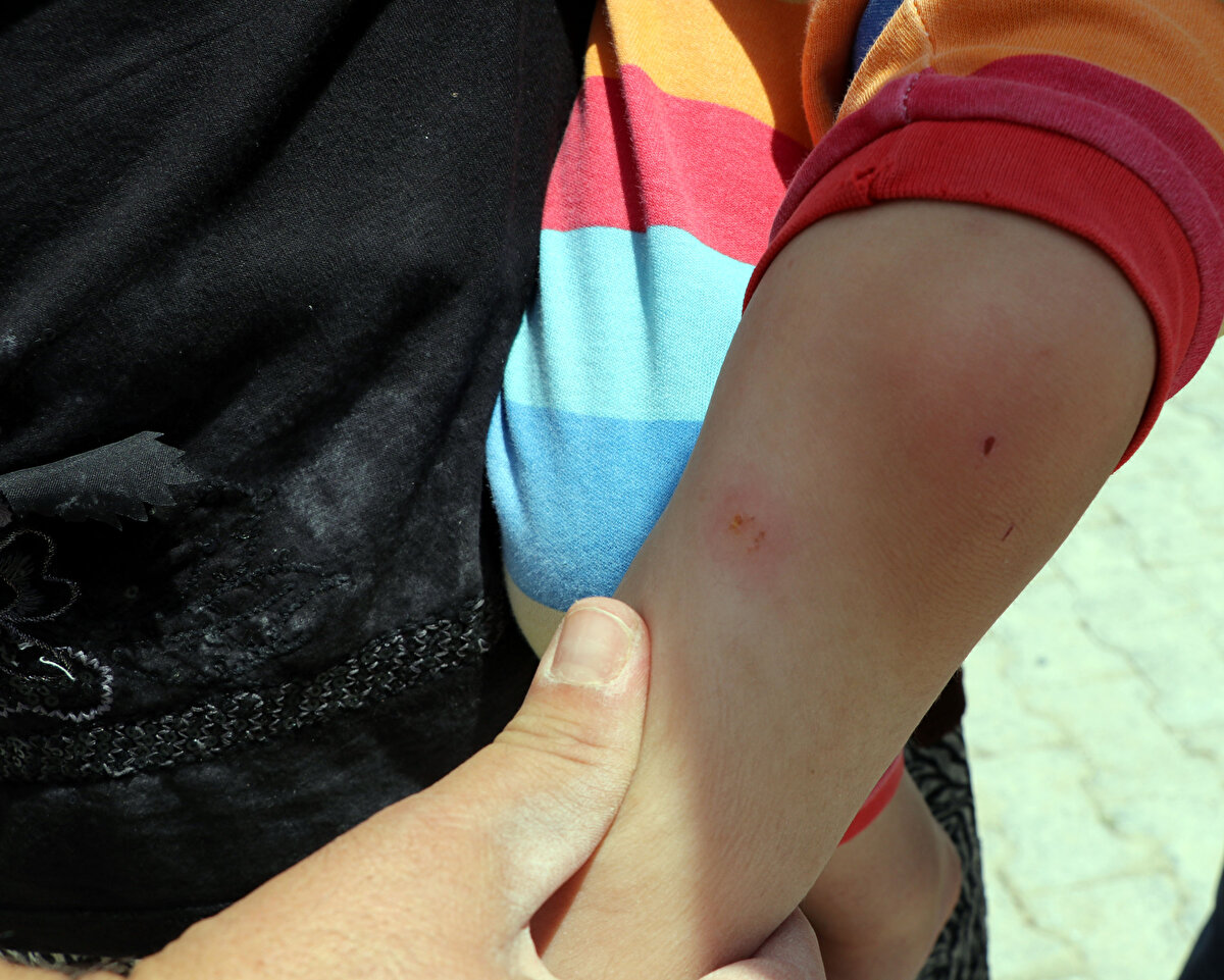 Evindeki yorganların bazılarını ateşe verip, bir kısmını da silkeleyen Dilber Tunç da "Mahallemizde akşam saat 20.00'dan sonra pire, bit ve sivri sinek kabusu yaşıyoruz. Bizi ısırıyorlar. Isırdıkları yer de kızarıyor ve şişiyor. Büyük sıkıntı yaşıyoruz. Bunların ilaçlanması gerekir. Ahır, ev ve tandır evinde her yerde var. Lütfen buna çare bulunsun" ifadelerini kullandı.

