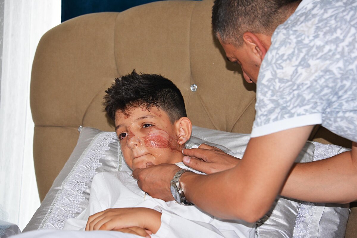 Oğlunun üzerindeki sünnet kıyafetinin bile parçalandığını söyleyen Bedri Kuytan, "O günü anlatmak çok zor inanın. Bahşişçiler evden çıktığımız andan itibaren arabanın önünü kesmeye başladılar. Yollara halatlar bağlamışlar. Taş atan var, bıçak çeken var. Biz geçmeden ipi kaldırdılar ben çocuğumu uyarana kadar olanlar oldu. Benim çocuğumun boynu kopacaktı. Bunun önüne yetkililerin geçmesi lazım. Bizim canımız yandı. Sabaha kadar uyuyamadık. Güzel günümüz rezil oldu. Hep hastanedeydik. Tek ricam bunun önüne geçilmesi. Çocuğumun yüzü ikiye bölünüp kesilebilirdi. Elbisesi bile ne hale geldi. Bunun hesabını kim verecek. 14-15 yaşlarındaydılar. Hepsi kaçtı" ifadelerini kullandı.