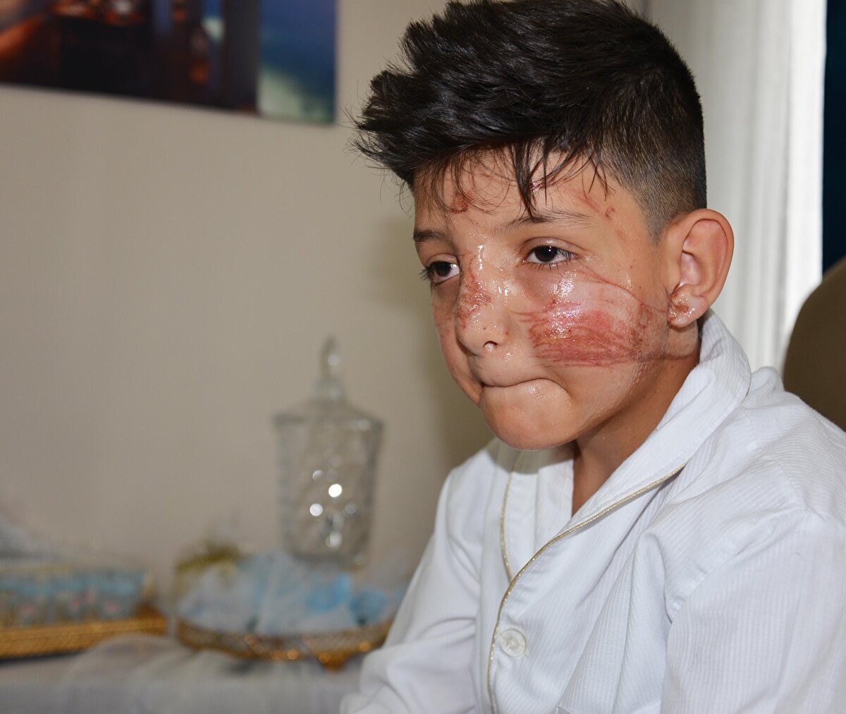 Çocuklar, sünnet arabasının geçişi sırasında yola çektikleri ipi kaldırdı. Bu sırada ip, aracın açılan üst bölümünden başını çıkaran Muhammet Samet Kuytan’ın yüzüne geldi. İpin boğazına takılmasından son anda kurtulduğu Kuytan, yaralandı.