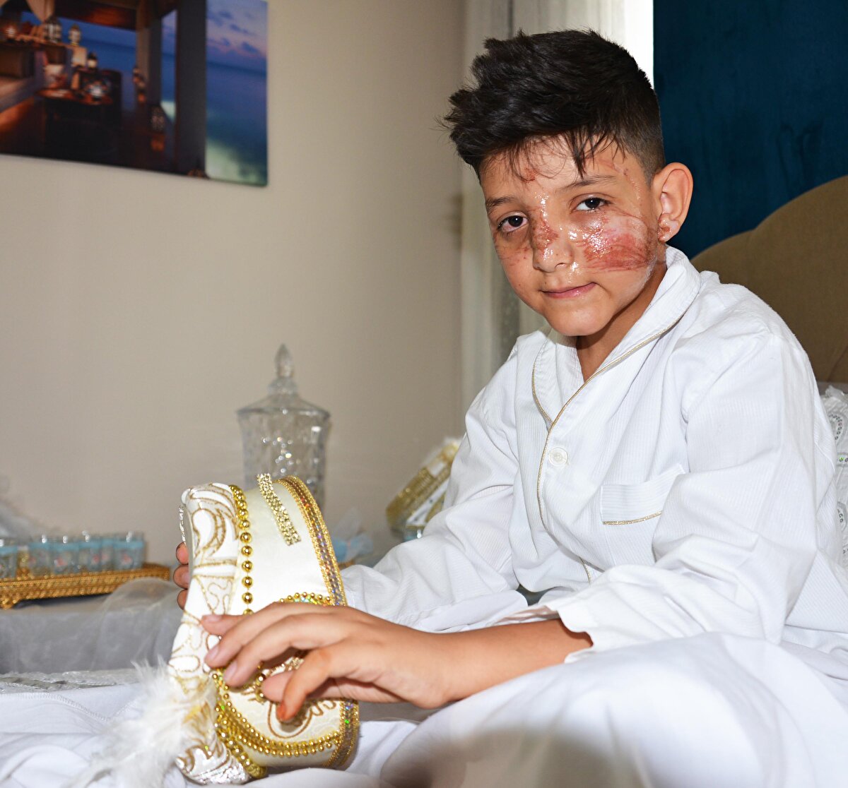 Boynu kırılmaktan son anda kurtulan Muhammet Samet Kuytan, başına gelenleri şöyle anlattı:
"Konvoyla türbe yoluna çıkıyorduk. Ben de araçta su içiyordum. Kafamı camdan çıkardım, o anda biz yoldan geçerken çocuklar ipi kaldırdı. İpi yüzümde hissettim, hemen oturdum. Annem 'Ne oldu?' diye sordu. Ne olduğunun farkında bile değildim. Babam arabayı sağa çekti. Yüzümde yanıklar var gibiydi. Korkudan yürüyemiyordum. Hastaneye gittik. Doktorlar krem verdi. Şimdi bu haldeyim. İp az daha kulağımı kesecekti. Beş lira için can bile alacaklar. Zaten benim yüzüm kesilince hepsi görüp kaçtı. Biraz hızlı gitseydik kesin boynum kopardı. Benim için güzel bir gün olacaktı. Heyecandan 06.00'da uyanmıştım. Hemen oturmasaydım ip boynuma takılıp beni aşağıya bile atabilirdi. Arabaların altına takla atabilirdim. İyi ki de eğilmişim de sadece yüzüm yaralanmış. Aynaya bakınca kendimi başka biri gibi hissediyorum. Dizilerde olduğu gibi ben de yüzüme bir şey kapatmak istiyorum."