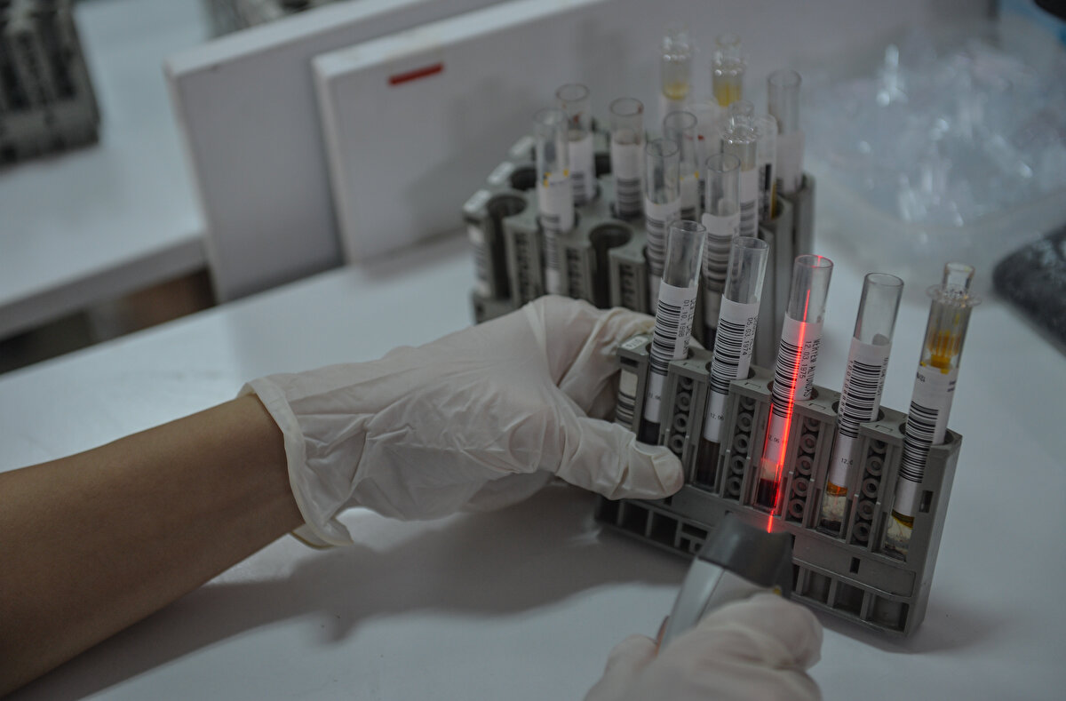 "Evet, yurt dışında PCR dışında hızlı antijen testlerinin kullanıldığını biz de okuyoruz. Bazı ülkelerde artık tanı algoritmasının içine bu tarama testlerinin de alındığı yönünde bilgiler var. Ama bizim ülkemizde bunun kararını verecek olan yer Bilim Kurulu..."