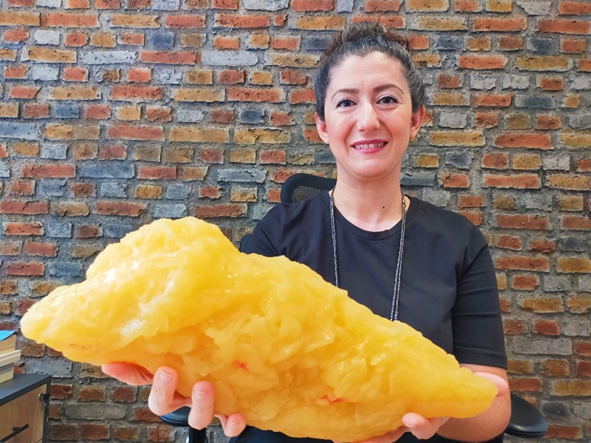 Bir poğaçada 10 küp şeker, bir simitte de 22 küp şeker bulunduğuna dikkati çeken Diyetisyen Çelakıl, sabahları en az iki poğaça yiyen kişinin damarlarında bulunan kanda tortulaşma oluştuğunu ve kılcal damarların tıkandığını vurguladı. 