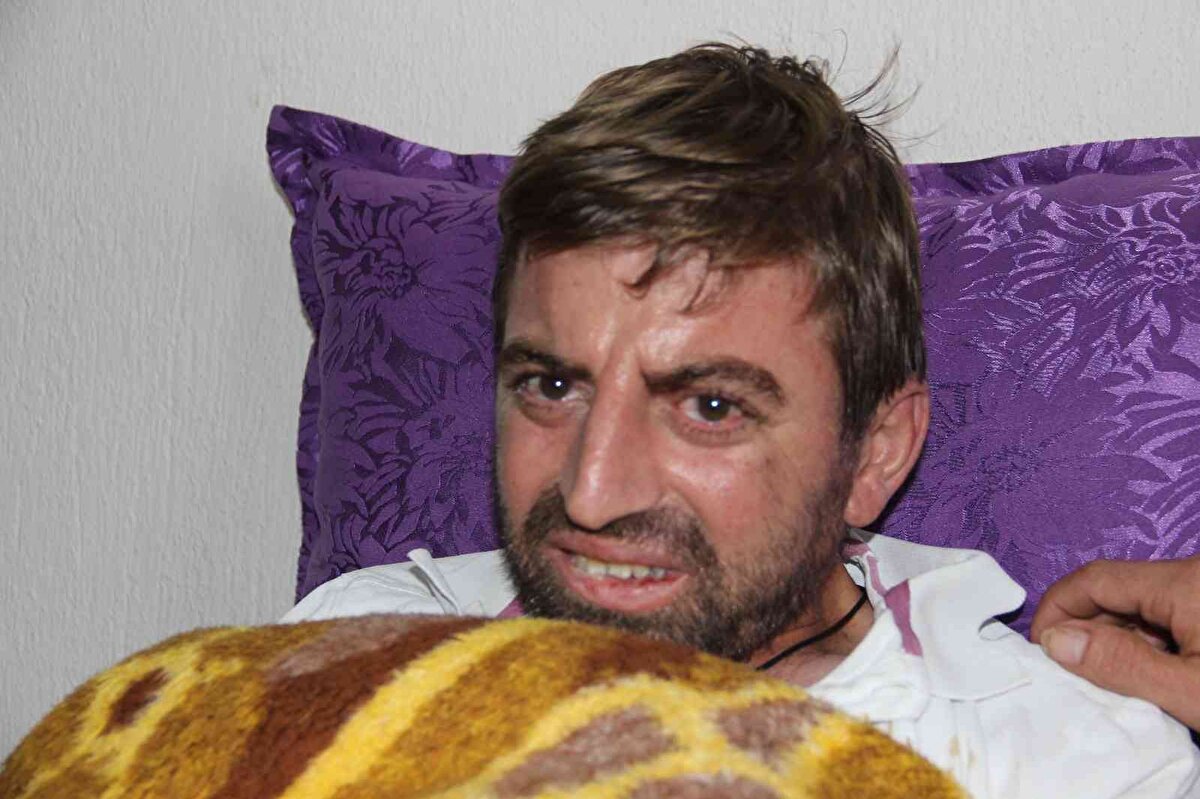 Kardeşinin hastalığına bir türlü teşhis konulamadığını kaydeden abi Ahmet Aktepe, "Diyarbakırlıyız. 8 kardeşiz. 4 kız 4 erkek. Anne ve babamız vefat etti. 2019 yılında kardeşim böbrek nakli oldu. Annem böbreğini verdi. Nakilden sonra kardeşim çok iyiydi. Annem de nakilden bir sene sonra aynı kardeşim gibi oldu ve vefat etti. Kardeşim iyiydi. 9 ay önce ayak ağrısından başladı sonra bu hastalık ilerlemeye başladı. Nereye götürdüysek vitaminsizlik dediler, mama verdiler. Son bir ayda tamamen yatalak oldu. Daha önce kız kardeşimin yanında kalıyordu. Kız kardeşim de rahatsız olduğu için yanıma aldım. İş yerimle konuştum bana daha fazla izin veremeyeceklerini söylediler ben de kardeşim için işten ayrıldım. Kardeşime bakıyorum. Bana para pul lazım değil sadece kardeşim tedavi olsun yeter" dedi.<br><br>