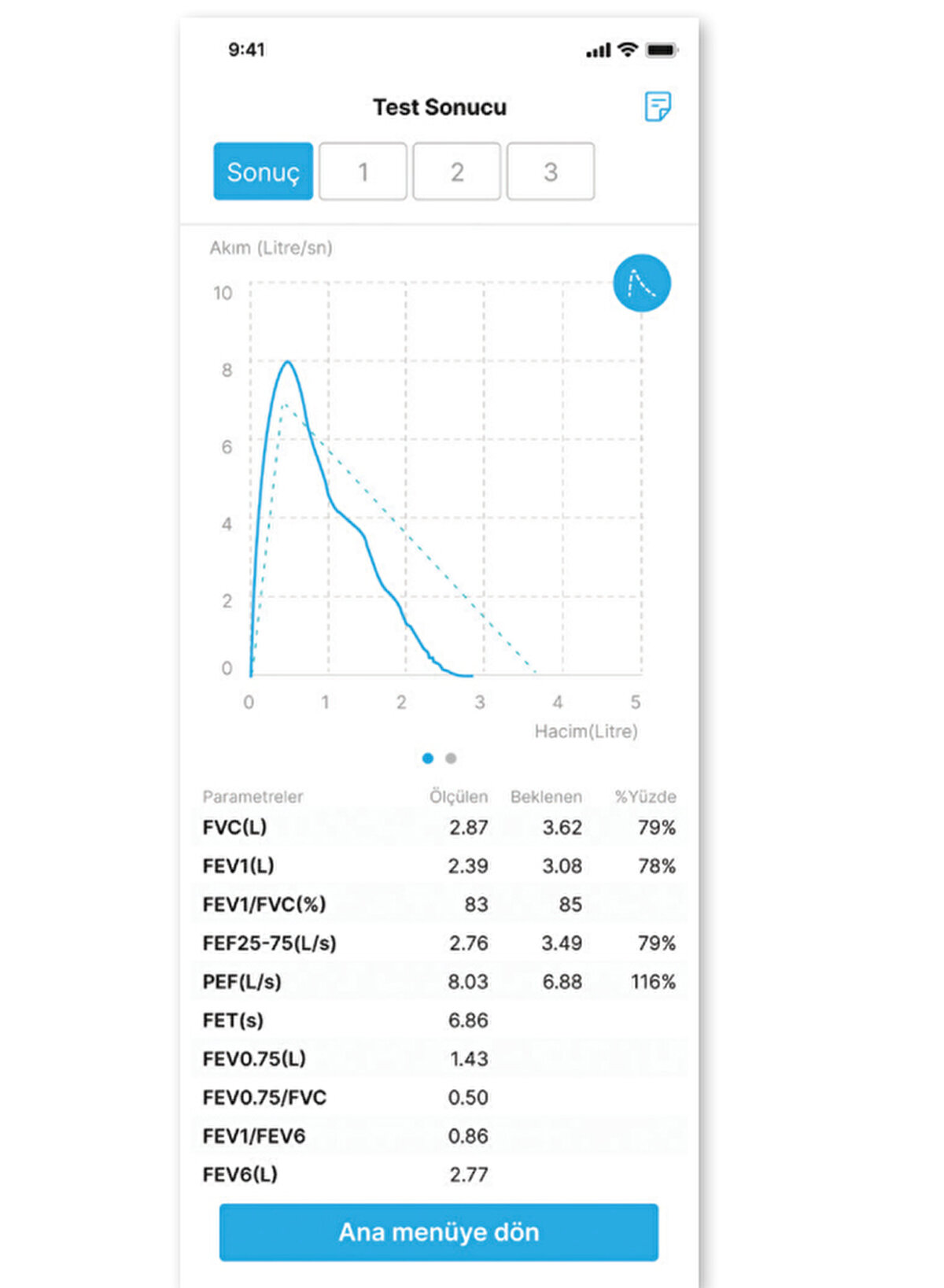 Çünkü sık sık hastane kontrolüne gitmesi gerekiyordu solunum fonksiyon testleri için. SpiroHome’u kullanmaya başladıktan sonra benim kaygı bozukluğum bile düzelmeye başladı.Çünkü sonuçları kötü çıksa bile hemen hemşire Burcu Hanım'la iletişime geçebiliyoruz. Mükemmel bir sistem, hayatımızı gerçekten çok kolaylaştırdı.Yoksa bir ayağım sürekli hastanedeydi. Ayda bir, 15 günde bir, hatta abzen haftada bir Tekirdağ'dan İstanbul'a gelip gitmek zorunda kalıyorduk. Aynı hastane ortamımızdaki gibi evde, haftada 2 defa (pazar ve çarşamba günleri) solunum fonksiyon testini yapabiliyoruz.Sonuçlarımız hemen hemşiremize ulaşıyor. Bir aksilik varsa, daha ben onu aramadan o beni arıyor. Teavi planlamalarını hemen değiştirebiliyoruz.Pandemi açısından da çok iyi oldu, 1 yıl boyunca ciddi anlamda hastane ortamlarından uzak kalabildik."<br><br><br><br><br><br><br><br><br><br>
