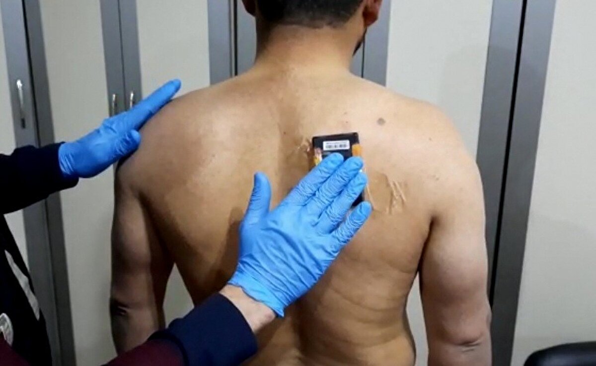 Edinilen bilgiye göre, E-Sınav Merkezinde gerçekleştirilen ehliyet sınavında bir şahsın kopya çektiğini gören görevliler, Osmaniye İl Emniyet Müdürlüğü'ne durumu bildirdi. Bunun üzerine harekete geçen ekipler, şüphelinin üzerinde arama yaptı. Yapılan aramada A.K. isimli şahsın sırt, el bileği ve ayak bileğine yerleştirilmiş wifi destekli kopya düzeneği belirlendi. 