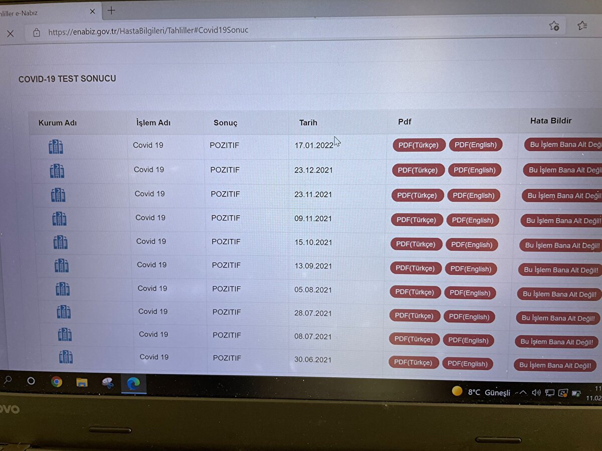 Kayasan, varyant açısından da sürekli takip altında tutulduğunu söyleyerek, "Varyant yok ama PCR testim hala pozitif.  Lösemiyle ilgili olduğunu söylüyor doktorlarım” dedi.<br>