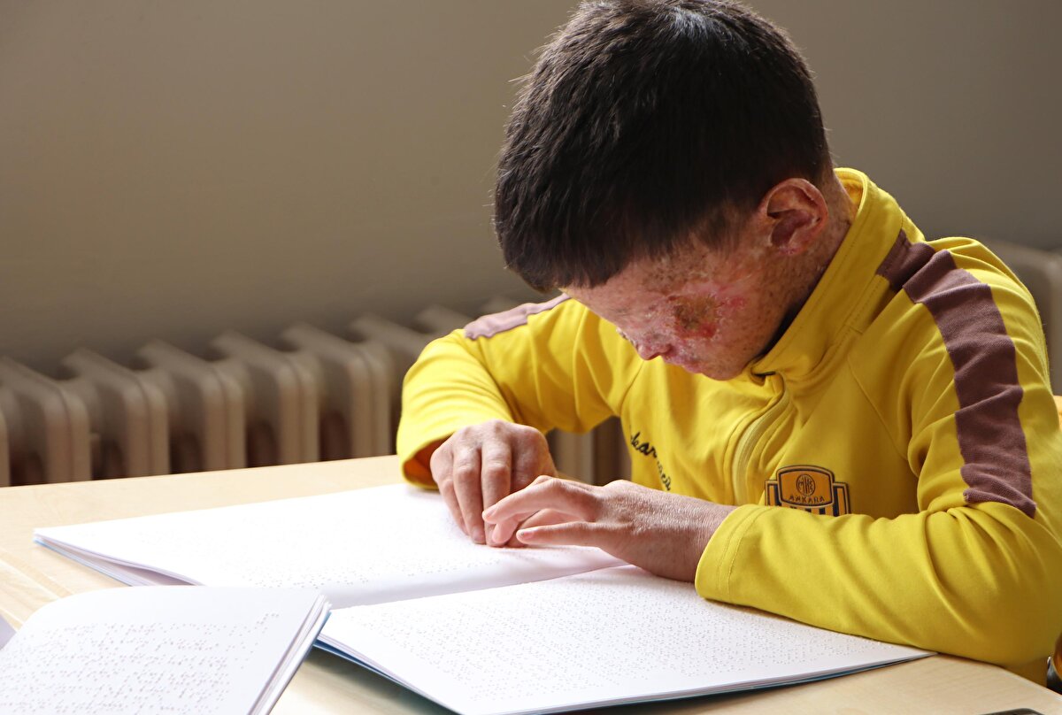 Güneşe alerjisi olduğu için dışarıya çıkamayan Salih'in karanlık odadaki yaşam mücadelesinin Demirören Haber Ajansı tarafından iki yıl önce haberleştirilmesinin ardından aileye yardım sağlandı. Sağlık Bakanlığı'nın da devreye girmesiyle Ankara'da tedavisine başlanan Salih'ten art arda iyi haberler gelmeye başladı. Damar yoluyla 3 seans uygulanan ilaçla, Salih'in boynundaki yara kapandı.<br>