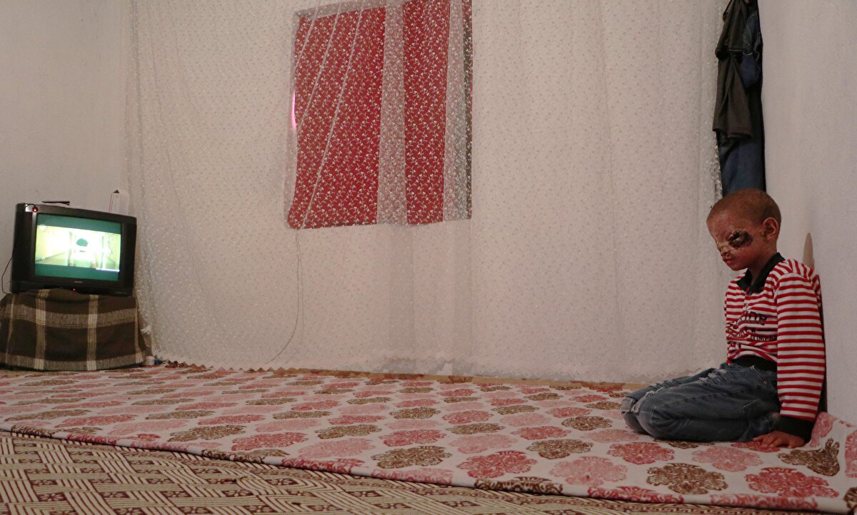 Sol gözündeki büyük yara küçülürken, iyileşmeye başlayan yaraları ise kabuk tuttu. Her geçen gün iyiye giden Salih İğneci'nin yaraları nedeniyle kapanan gözleri de ışığı algılamaya başladı. Aile köyden çıkarak şehir merkezine taşındı. Salih İğneci, gittiği görme engelliler okulunda çok mutlu ve o çok korktuğu ışıktan da etkilenmiyor.<br><br>