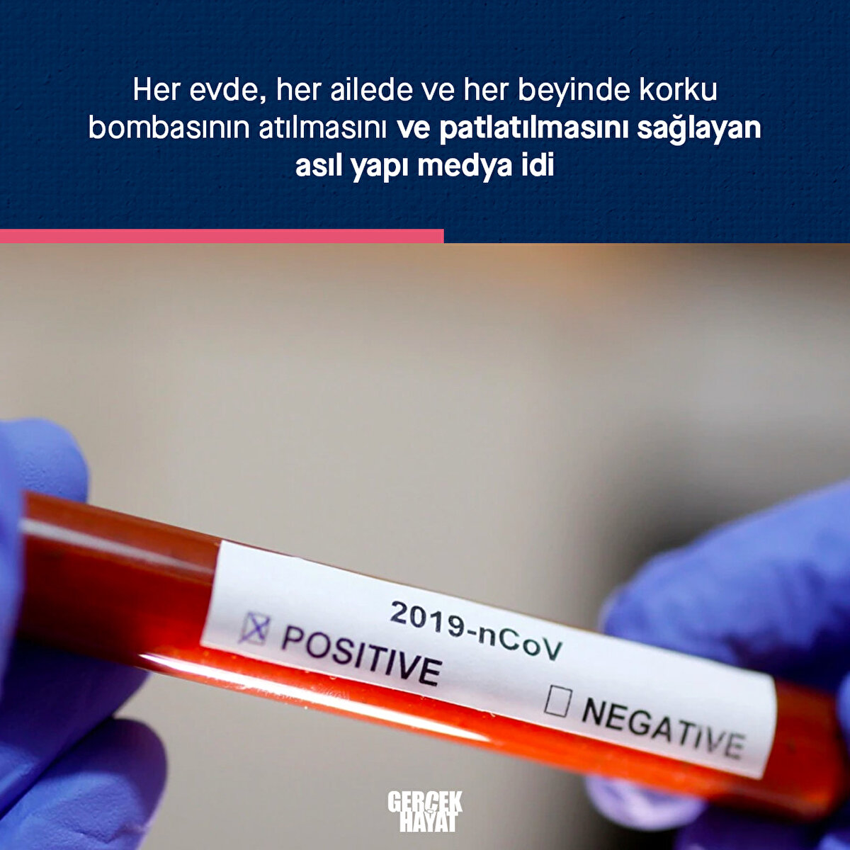 İnsanları yönlendiren asıl yapı medya oldu