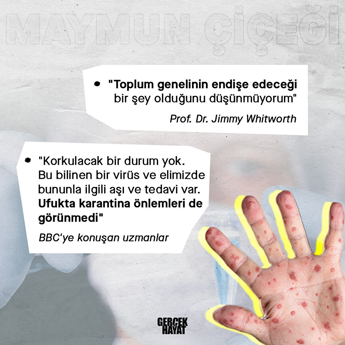 Endişelenmeye gerek yok