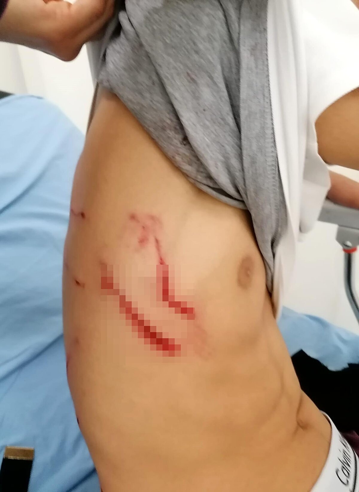 Yaklaşık 10 köpeğin arasında kalan Efe, öğretmenlerinin müdahalesiyle kurtarıldı. Vücudunun çeşitli yerlerinden yaralanan Efe, çağrılan ambulansla Ankara Şehir Hastanesi'ne kaldırıldı.<br><br>