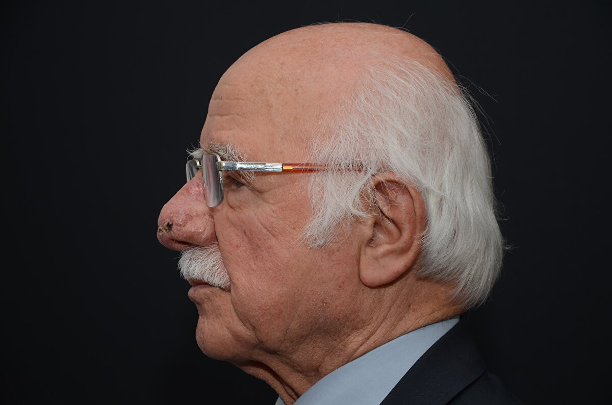 Başarılı geçen ameliyatın ardından sağlığına kavuştuğunu anlatan Ramoğlu, "Çevremdeki insanlar 'Neden ameliyat olmuyorsun, neyi bekliyorsun?' diyorlardı.