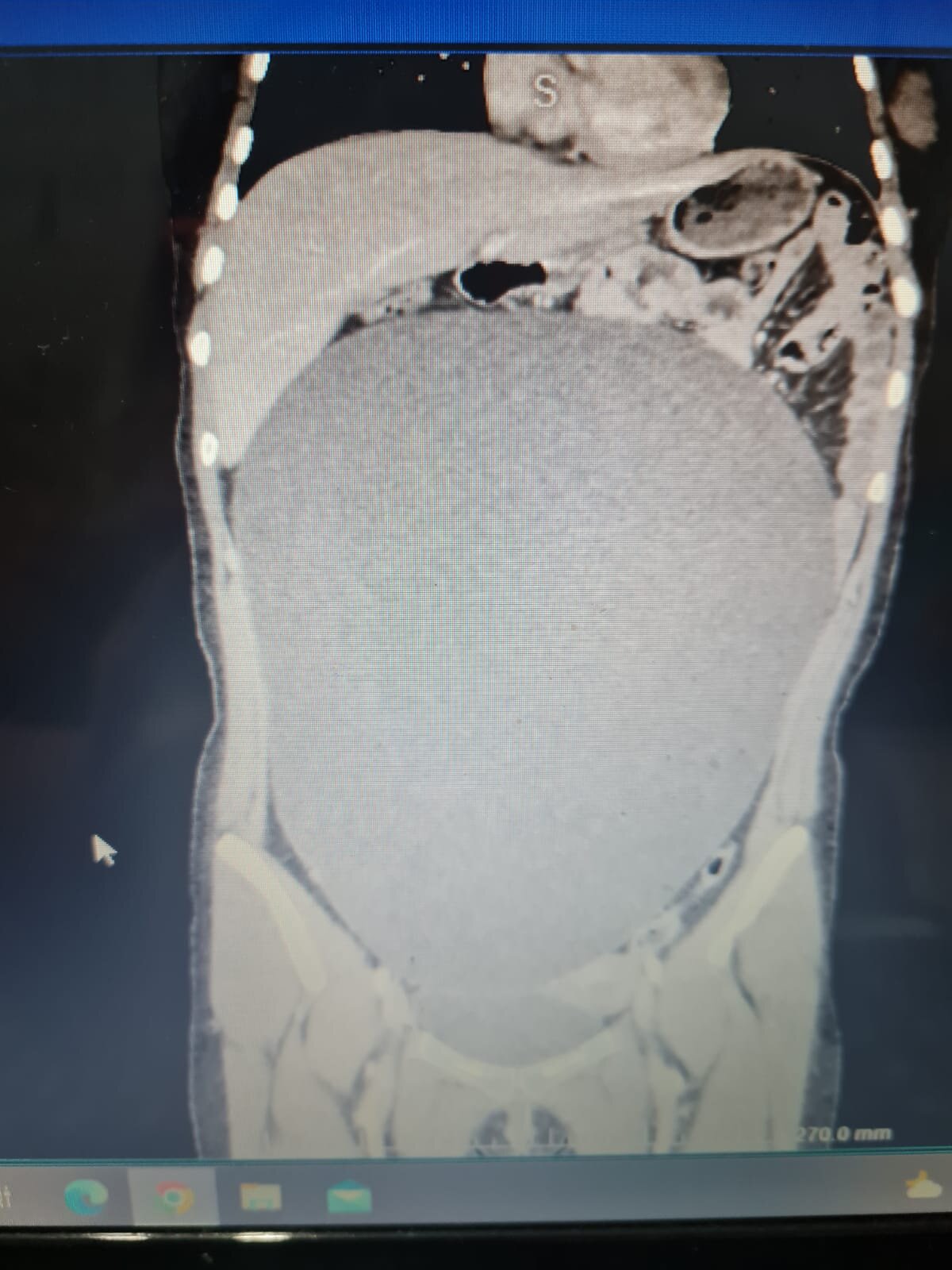 Kaza vakası sonrası böyle bir olayı ilk kez yaşadıklarını belirten Öztürk, ''Kızımız, bir trafik kazısı geçiriyor ve kendisine otobüs çarpması sonrası acil servise getiriyor.