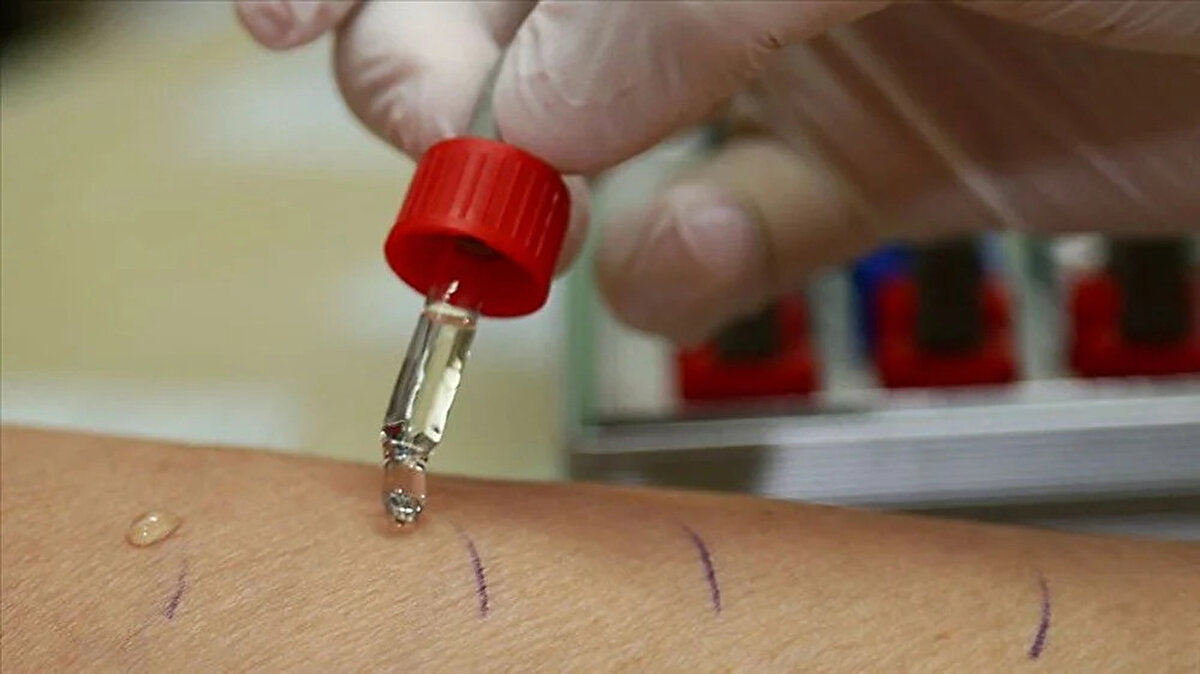 Ölümcül hastalıkların başında gelen ve her 2 dakikada bir çocuğun ölümüne neden olan sıtma, en çok Afrika'da görülüyor.<br><br>Sıtma nedeniyle kıta genelinde her yıl ortalama 500 bin kişi hayatını kaybederken ölenlerin yarısını çocuklar oluşturuyor.