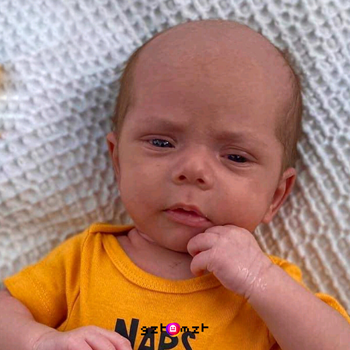 Saç çizgisi bile var