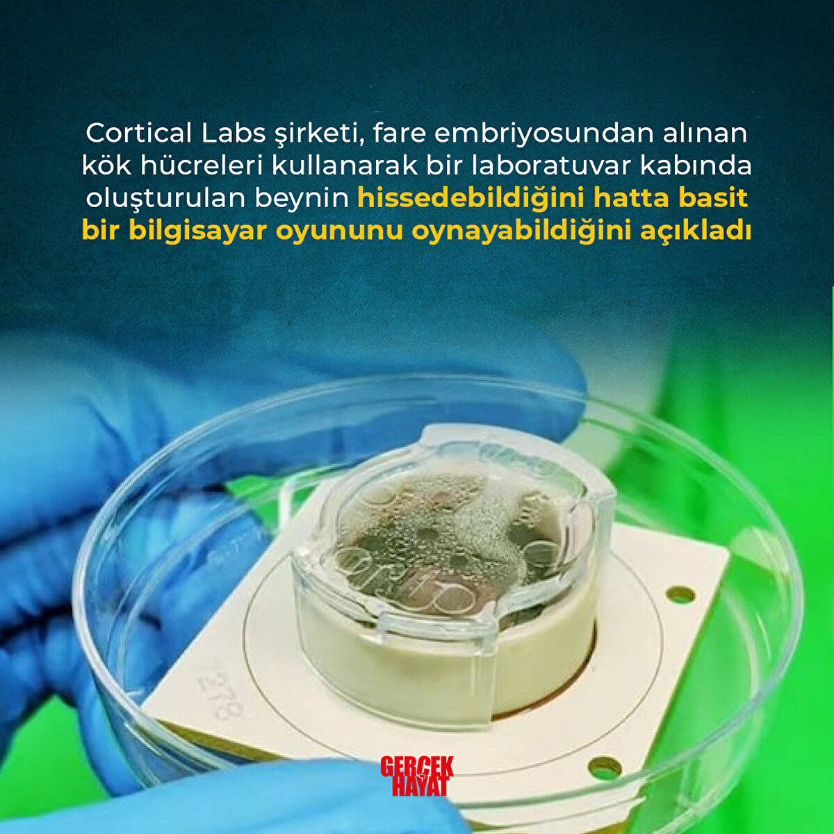 Hatta basit bir bilgisayar oyununu oynayabildiğini a&#231;ıkladı