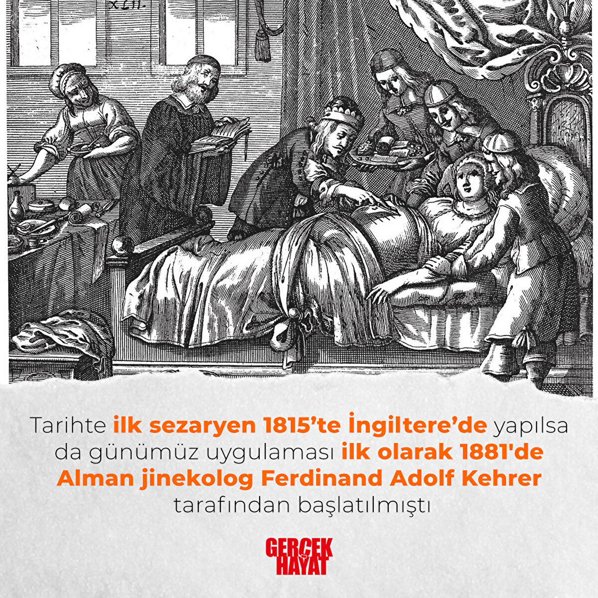 1881'de Alman jinekolog Ferdinand Adolf Kehrer tarafından başlatılmıştı