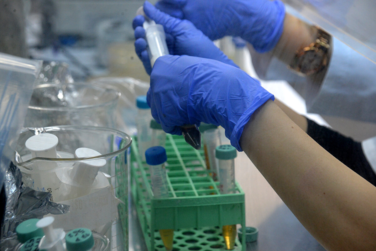 Eğer gıdadan kaynaklanan bir riskten korunmak istiyorsanız; bu ürünü evde dahi hazırlayacak olsak temiz ortam, kişisel hijyen, temiz eller, temiz su, sebze ve yeşilliklerin iyi yıkanması, etin kaliteli olması ve mümkünse şu an çiğ köfteye hiç et konmaması ama içine konulan her şeyin çok iyi temizlenmiş, yıkanmış olarak hazırlanması, steril eldivenlerle yoğurma işleminin yapılması gerekiyor.