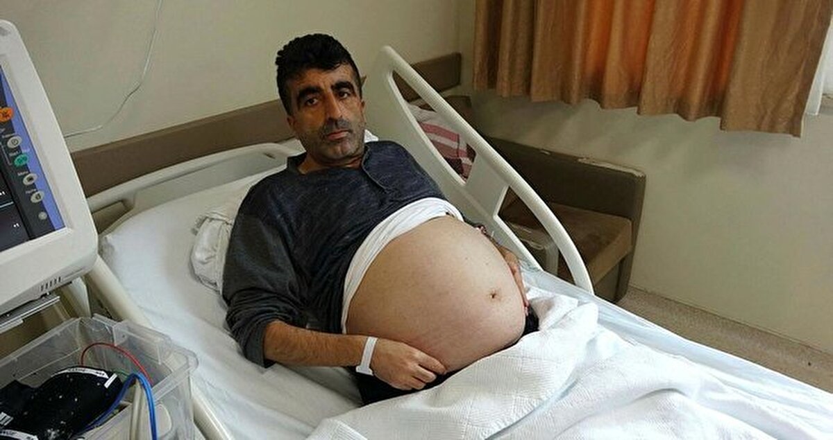 Prof. Dr. Namık Özkan, kilo aldığını düşünen hastanın şikayetlerinin artması üzerine yapılan tetkiklerde 30x30 karın bölgesinde kitlenin tespit edildiğini kaydetti. Ameliyatla karın arka duvarındaki yağ dokusundan gelişmiş olduğu tespit edilen kitlenin çıkartıldığını belirten Özkan, "Ameliyat yaklaşık 3 saat sürdü. Böbrek, idrar yolları ile karın arka duvarlarındaki damarlarla yakın ilişkili idi. Aynı zamanda böbrekle ilişkili olduğu için ürolojiden bir hocamızda ameliyata eşlik etti. Başarılı bir operasyonla kitleni tamamını çıkarttık" dedi.<br><br>