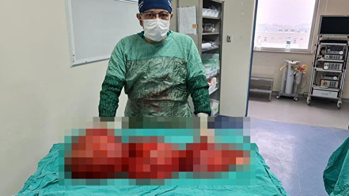 Bu tür vakalarla çok sık karşılaşmadıklarını belirten Özkan, "Daha öncede bu tür kitleler çıkarttığımız oldu. 8-11 kiloluk çıkarttığımız kitleler oldu. Hasta biraz daha beklese çok daha büyük boyutlara gelebilirdi. Bunlar sürekli büyüyen kitleler. Çokta geç kalmadan kitleyi temizleyebildik" diye konuştu.<br><br>