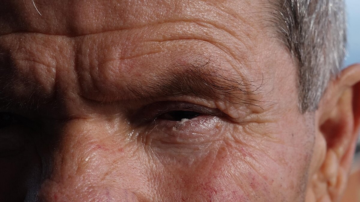 Özel göz hastanesinin yönetim kurulu başkanı Opr. Dr. Can Kaya da yazılı açıklamada bulundu. Ameliyat ve tedavi sürecinin başarıyla tamamlandığı belirtilen açıklamada, şunlar kaydedildi:<br>