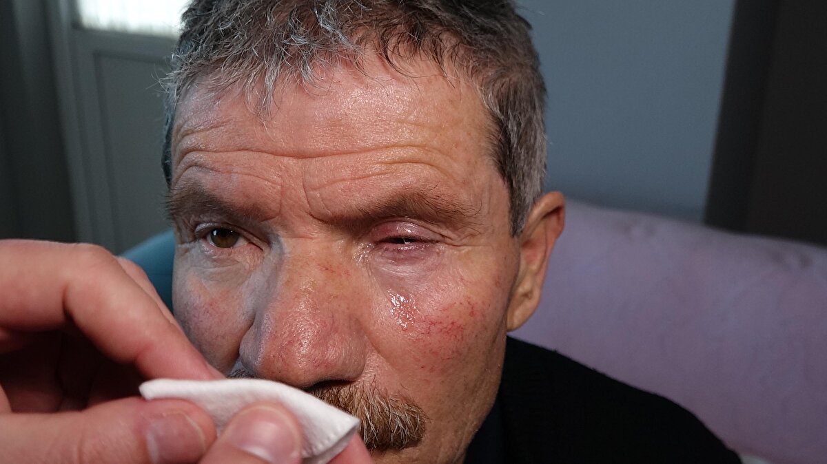 Yaşadıklarını anlatan Sebahattin Aydın, “Katarakt için özel göz hastanesine gittim. Muayene olduktan sonra ameliyata alındım. Ameliyat sonrası ağrılarım devam etti. Sonra yeniden hastaneye gittim. Beni defalarca ameliyata aldılar. ‘Gözüm daha iyi görsün’ diye gittim, kör oldum çıktım. Ağrılarım tıp fakültesi hastanesinde 14 gün yattıktan sonra son buldu ama gözüm görmüyor. Öldüm, dirildim. Hayati tehlikem vardı. Çektiğim ağrılar dayanılmazdı. Şikayetçiyim” diye konuştu.<br>