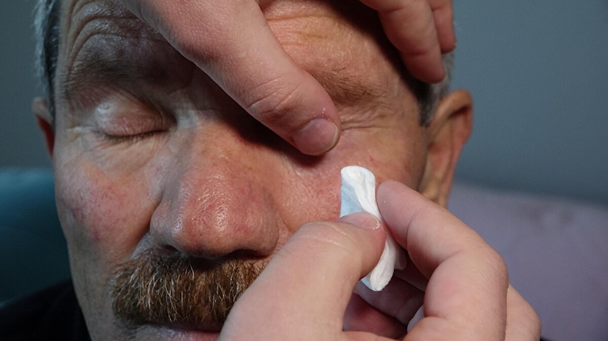 Babasına tedavi sürecinde refakat eden İbrahim Aydın da “Toplam 4 defa babam özel göz hastanesinde operasyon geçirdi ama şifa bulmadı. Şu an babamın gözü görmüyor. İnsanlar özel hastaneye daha iyi tedavi almak için gidiyor ama biz özel hastaneye sağ bir gözle girdik, kör bir gözle çıktık. Özel göz hastanesinde babamın gözünden alınan kültür kentte bir devlet hastanesine incelenmek için başka hasta ismiyle gönderildi. 2 hastane hakkında suç duyurusunda bulunduk. Sürecin takipçisiyiz” dedi.<br><br>