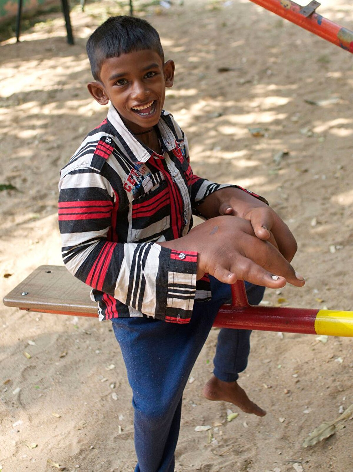 Kaleem'in şu anda en büyük şikayeti ise köylülerinden yana. Ellerini gören kimsenin yanına yaklaşmadığını belirten Kaleem, yapılan ayrımcılık nedeniyle isyanını dile getiriyor.<br><br>