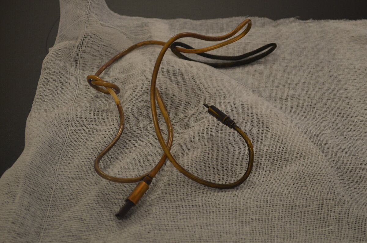 Kabloyu çıkarırken açıkçası zorlandık, çünkü kablonun bir ucu ince bağırsağa geçmişti. İşlem başarılı bir şekilde sonlandırıldıktan sonra hasta sağlıklı bir şekilde evine gönderildi" dedi.