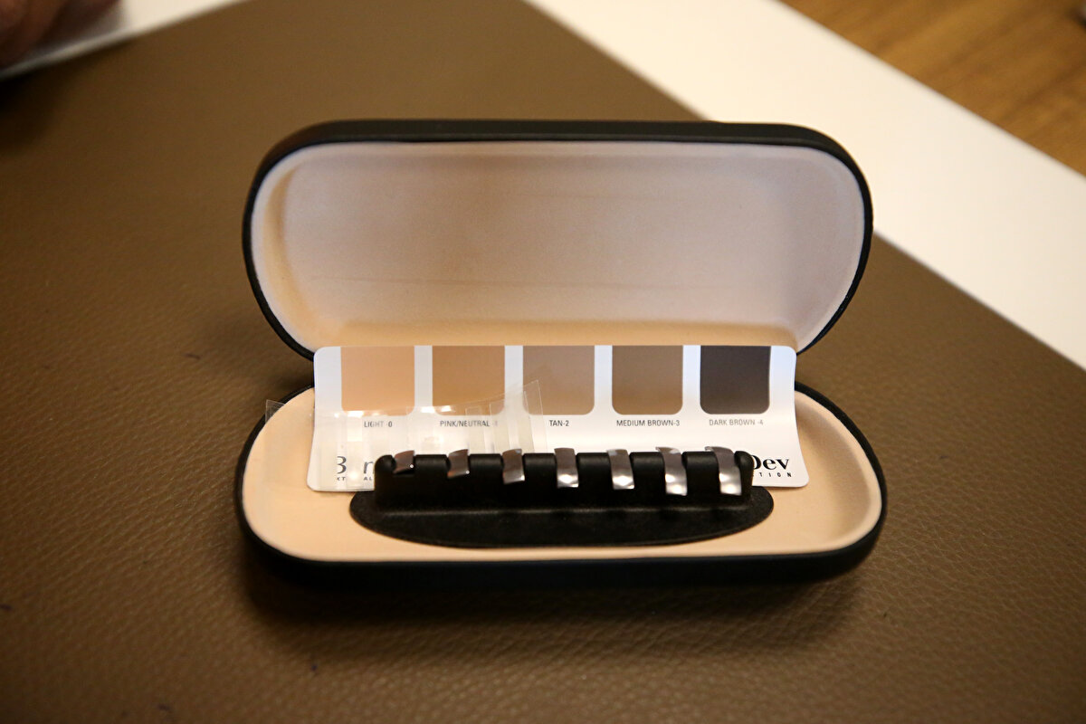 Evereklioğlu, her hasta için farklı ağırlıkta altın kullandıklarının altını çizerek, şöyle devam etti:<br><br>"Burada bizim metal ayarlama ölçeklerimiz var. Kaç gramla kapak yeterince kapanabiliyorsa minimumunu hesaplıyoruz. Minimum hangisiyle kapanabiliyorsa o kadarı yeterli oluyor. Kuyumcuya nasıl imal etmesi gerektiğini anlatıyoruz. Bu, yapılacak kapağa göre eğri imal edilir. Üstünde de 3 delik olur, o deliklerden dikişle kapağa dikilir."<br><br>Hastaların bu tedaviyi duyduklarında şaşkınlık yaşadığını belirten Evereklioğlu, bu tedavi için genelde 1-2 gram altın kullandıklarını ifade etti.<br><br>Kuyumcu İbrahim Eser de kendilerinden istenen ölçüde altını göz için uygun hale getirdiklerini söyledi.<br><br>İşlemlerde önemli noktalar olduğunu belirten Eser, "Birincisi 24 ayar has altın olacak. İstenen ölçülerde ve gramda olacak. Bu, göz kapağının içerisine yerleştirileceği için hiçbir çıkıntısı, sivri parçası olmaması lazım. Göz kapağının anatomik yapısına uygun olması gerekiyor. Biz o ölçülerde yapıp hastalara teslim ediyoruz." dedi.