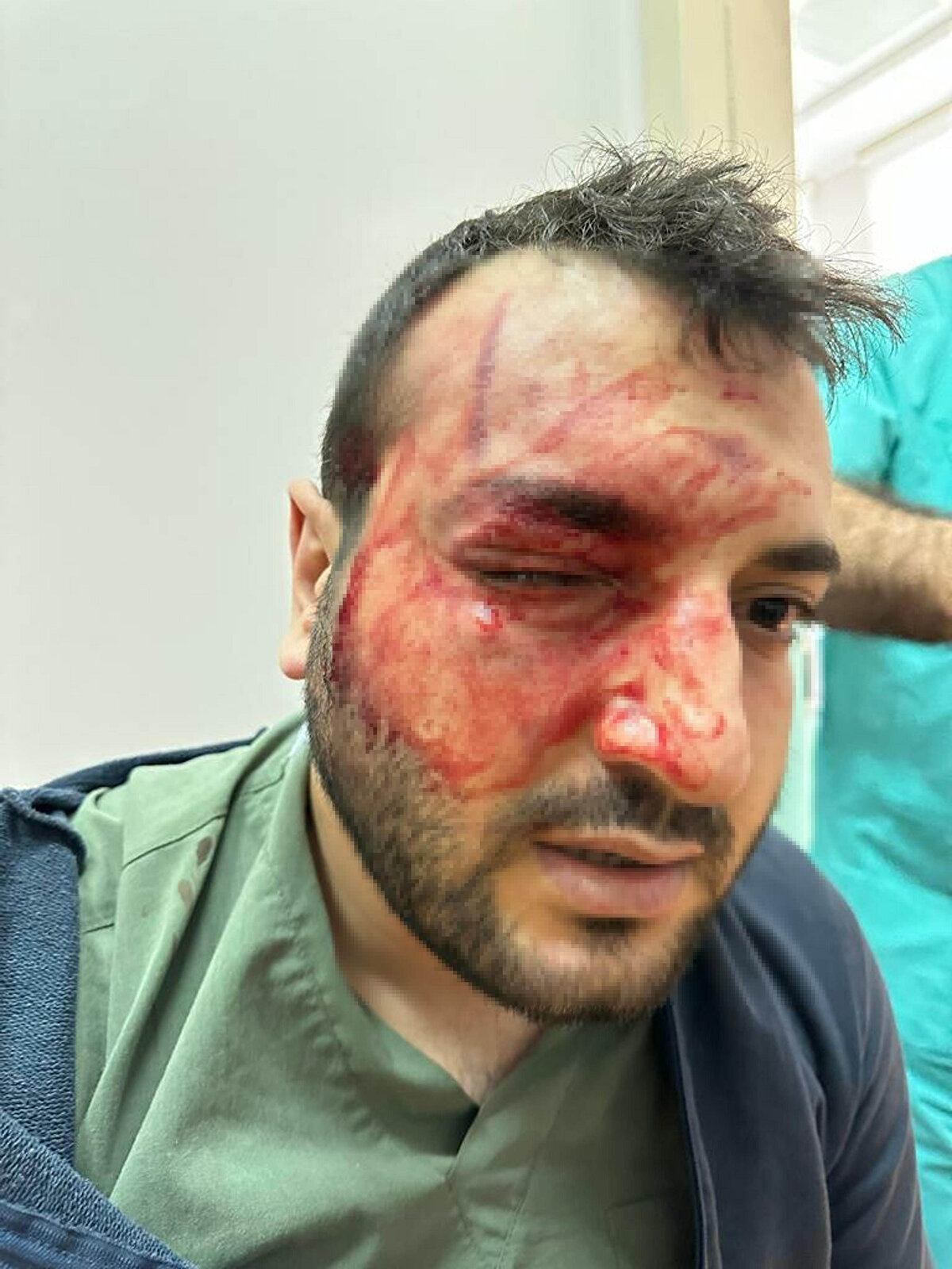 Karşılaştığı cerrahi baskı nedeniyle olayların yaşandığını öne süren anestezi asistanı Dr. Muhammed Ali Ertan, "Dr. İsmail Şayan, 'Hastayı çabuk uyandıralım. Çok vakamız var. Ne ilaç varsa verin uyansın' diyerek, sert bir üslupla bana baskı yaptı. Ben de bu işin böyle olmayacağını belirtip, 'Hasta tamamen derlenmeden, salondan çıkaramam, vakanın çokluğu beni ilgilendirmez. Benim işim şu anki hastanın sağlığı, işime karışmayın' dedim. Aramızda kısa bir tartışma oldu." dedi.<br><br>