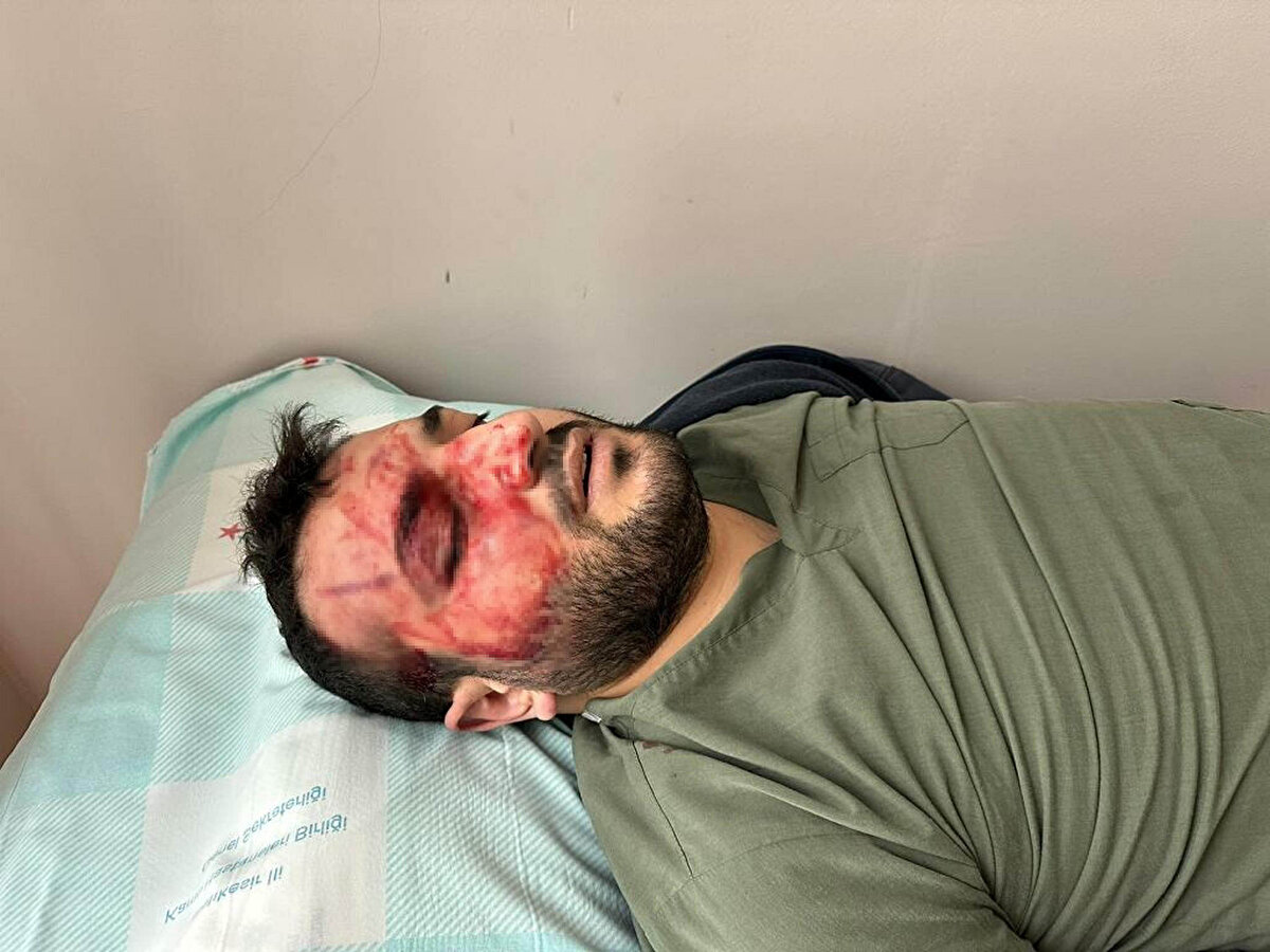 Anestezi asistanı Dr. Ertan, jandarma, Balıkesir Tabip Odası ve Balıkesir Üniversitesi Rektörlüğü'ne giderek kendisini dövdüğünü ileri sürdüğü doktorlar Azad Gazi Şahin, İsmail Şayan ve Uğur Mengeneci hakkında şikayetçi oldu. Asıl kendilerinin mağdur olduğunu ileri süren 3 doktor da Ertan için jandarma ve Balıkesir Tabip Odası'na şikayette bulundu.<br><br>