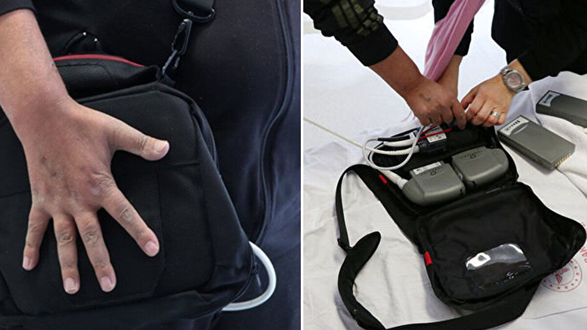 İki kız çocuğu babası 41 yaşındaki Serkan Aş, 2 yıl önce kalp ve böbrek yetmezliğiyle karşı karşıya kaldı. Durumu hızla kötüleşen ve çoklu organ yetmezliği riskiyle yaşamı tehlikeye giren Aş, sevk edildiği Bilkent Şehir Hastanesi Kalp-Damar Hastanesinde aylarca yoğun bakımda tedavi gördü.