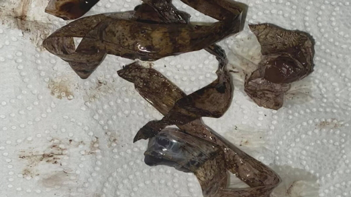 Havalimanı yakınında Arnavutköy'de bir otele yerleşen Rupen Harotonian, kaybettiği pasaportu yeniden çıkarmak için işlemleri başlattı. 