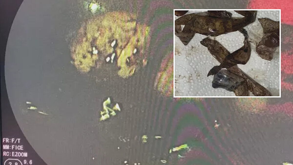 63 yaşındaki Rupen Harotonian, İran'dan bindiği uçak ile İstanbul Havalimanı'na geldi. Rupen Harotonian İsveç pasaportunu kaybedince aktarma yapacağı İsveç uçağına binemedi. 