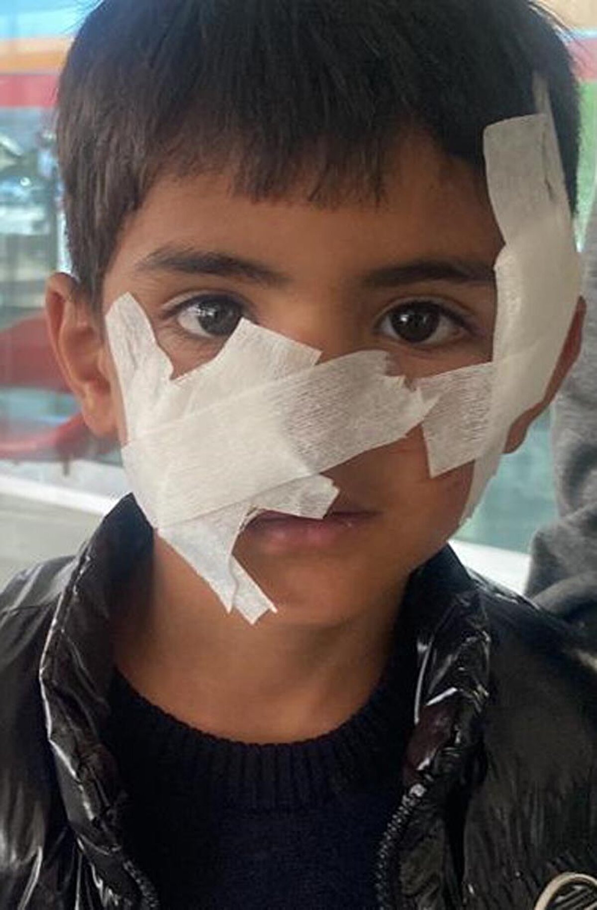 Çığlık seslerini duyan babaanne Şahsenem Karadağ, köpekleri uzaklaştırmayı başardı. Yaralanan çocuk Sarıkamış Devlet Hastanesine kaldırıldı. Hastanede, yüzünden ve vücudunun çeşitli yerlerinden yaralandığı tespit edilen Karadağ'a 40'ın üzerinde dikiş atıldı. Kuduz tedavisine başlanan Karadağ, taburcu edilerek evine gönderildi.<br>