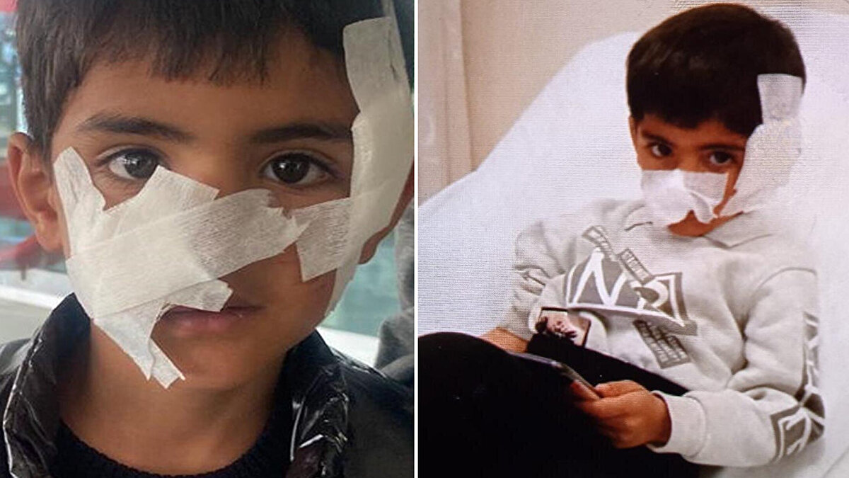 Kars'ın ​Sarıkamış ilçesi Armutlu köyünde yaşayan Aysel-Kenan Karadağ çiftçinin oğulları Harun Karadağ, iki arkadaşı ile birlikte evlerinin önünde oyun oynarken köpeklerin saldırısına uğradı.