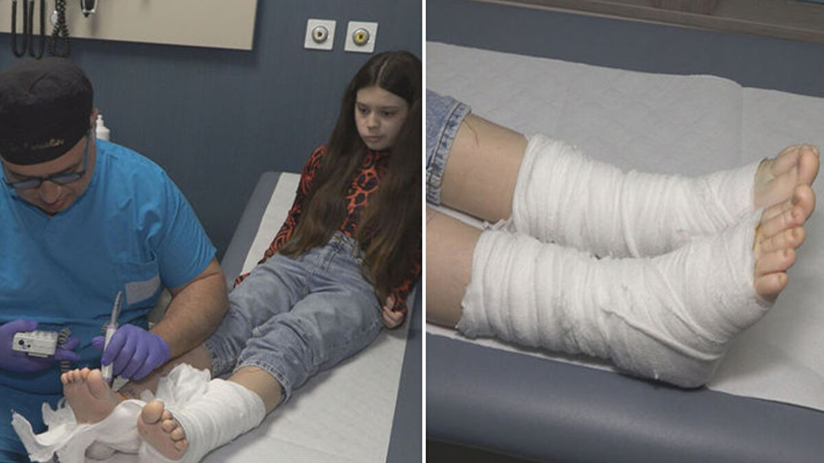 Romanya'da yaşayan 15 yaşındaki Andrea Timeea Mitrea, her iki bacağında doğuştan meydana gelen dolaşım bozukluğu nedeniyle henüz 14 yaşındayken lenfödem hastası oldu. Hastalığı zamanla ilerleyen Andrea'nın ayakları sürekli şişmeye, yaşıtları gibi yürüyememeye başladı. Kol veya bacakların devasa boyutlara ulaştığı “fil hastalığına" doğru ilerleyen durumu için ailesi, hem kendi ülkelerinde, hem de Almanya, Fransa, hatta Amerika'da çalmadık kapı bırakmadı. Bacaklarına vücudunun başka bir bölgesinden lenf bezi nakli yapılması gerekiyordu ama sorun, her iki bacakta da olduğu için hiçbir cerrah bu ameliyata yanaşmadı. Ailesi, siyam ikizlerini ayırma operasyonundaki başarılarıyla da adından söz ettiren ve lenf bezi naklinde literatüre giren operasyonlar gerçekleştiren Estetik, Plastik ve Rekonstrüktif Cerrahi Uzmanı Prof. Dr. Mehmet Veli Karaaltın'a ulaştı.