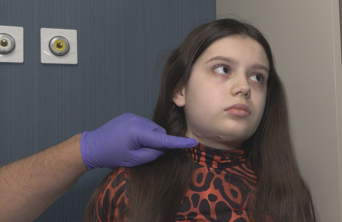 Prof. Dr. Karaaltın, “Vücudumuzun bir atık sistemi var. Tıpkı fabrikalardaki gibi bu atıkları toplayan sisteme, 'lenfatik dolaşım sistemi' diyoruz. Burada herhangi bir yerde bir aksaklık meydana gelebilir. İşlevsel kayıp olabilir, cerrahi sonrası olabilir, bazen kanser hastalarının lenf bezleri bilerek alınabiliyor örneğin, ya da doğuştan yetersizlik oluşabilir. Bu hastalarda, hücreler arası organ dediğimiz bölgede; o atıklar birikmeye başlıyor. Bunlar ödeme neden oluyor  ve çok ilerlediği seviyelerde de fil hastalığı dediğimiz tablo ortaya çıkıyor. Bağışıklık sistemimiz, bu ödemden rahatsız olduğu için bunu bir şekilde vücut dışına atmaya çalışıyor ve bunun için de oraya savaş açmaya başlıyor. Ama aynı zamanda oradaki sağlıklı hücrelere de saldırdığı için, bu hastalık gitgide ilerleyici bir hal alıyor. Hastalığın kesin tedavisi yok ama evresini durdurmak mümkün. Böylece bacağın ya da kolun kalınlaşmasını engelleyebiliyorsunuz. Bu evreyi ne kadar küçük tutarsak, ne kadar erken müdahale edersek, hastanın yaşam kalitesi ve hareket kabiliyeti o kadar olumlu yönde etkileniyor" dedi.<br>