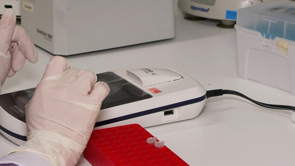 Araştırmalar neticesinde Küçükçekmece Gölü'ne kesinlikle girilmemesi gerektiğini vurgulayan Meriç Albay, şunları anlattı:<br><br>“Girilmemesi lazım çünkü mikrobik olarak, mikrobiyolojik parametreler bakımından oldukça sıkıntılı. Oradan birçok hastalığı kapmaları söz konusu. Girilmesine izin vermemek lazım. Hatta orada balıkçılığın da yasaklanması lazım. Balıkçılık faaliyeti zaman zaman görüyorum, kesinlikle tutulmaması lazım. Çünkü ağır metal kirliliği bakımından, mikro kirleticiler bakımından oldukça sıkıntılı bir alan. Çocukları kontrol edemezsiniz. Oraya giriyorlar, ellerini yıkıyorlar, ağızlarına sürüyorlar, mikrop kapmaları olası. Dolayısıyla bir an önce şehre kazandırılıp, dünya mirası olarak dünyaya kazandırılmasında fayda var diye düşünüyorum.”