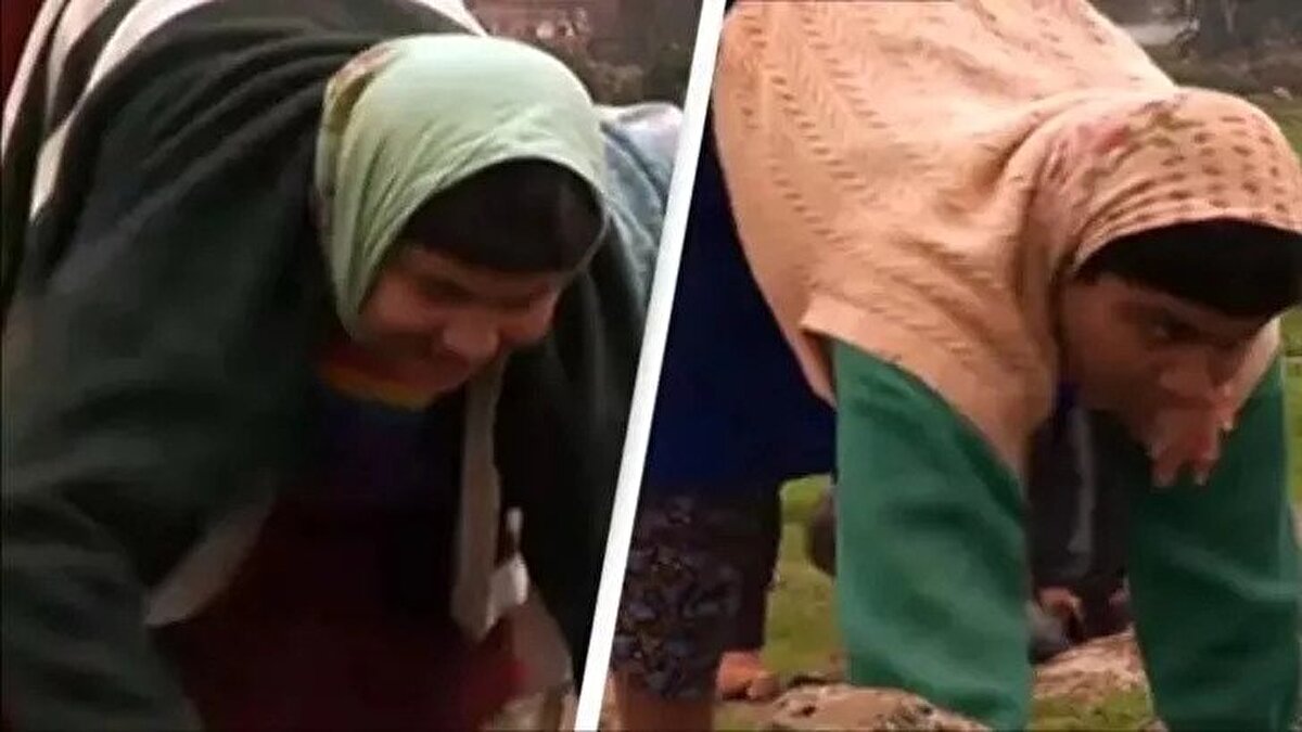 Humprey çocukların hareket kabiliyetinde son derece önemli iyileşmelerin meydana geldiğini gördü. Bu nedene bağlı olarak ailenin yetiştirme tarzı üzerinde duruluyor.<br><br>Bilim insanına göre çocuklar 9. aydan sonra ayakta durmaları için teşvik edilmedi. Bu sebeple gelişimleri etkilendi.<br><br>Dört ayaklı aile tüm dünyanın ilgisini çekmeye devam ediyor.