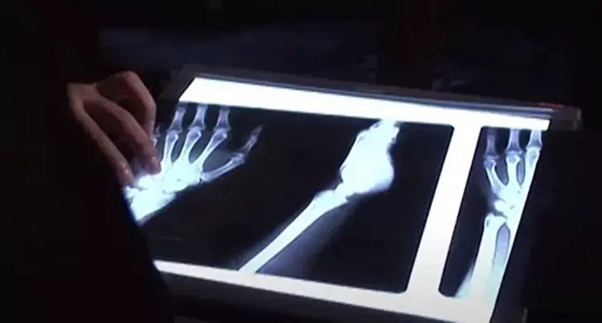 Yürürken parmaklarından ziyade avuç içlerini kullanan Ulaş ailesi bu noktada evrimsel olarak farklı bir özellik taşıyor.<br><br>