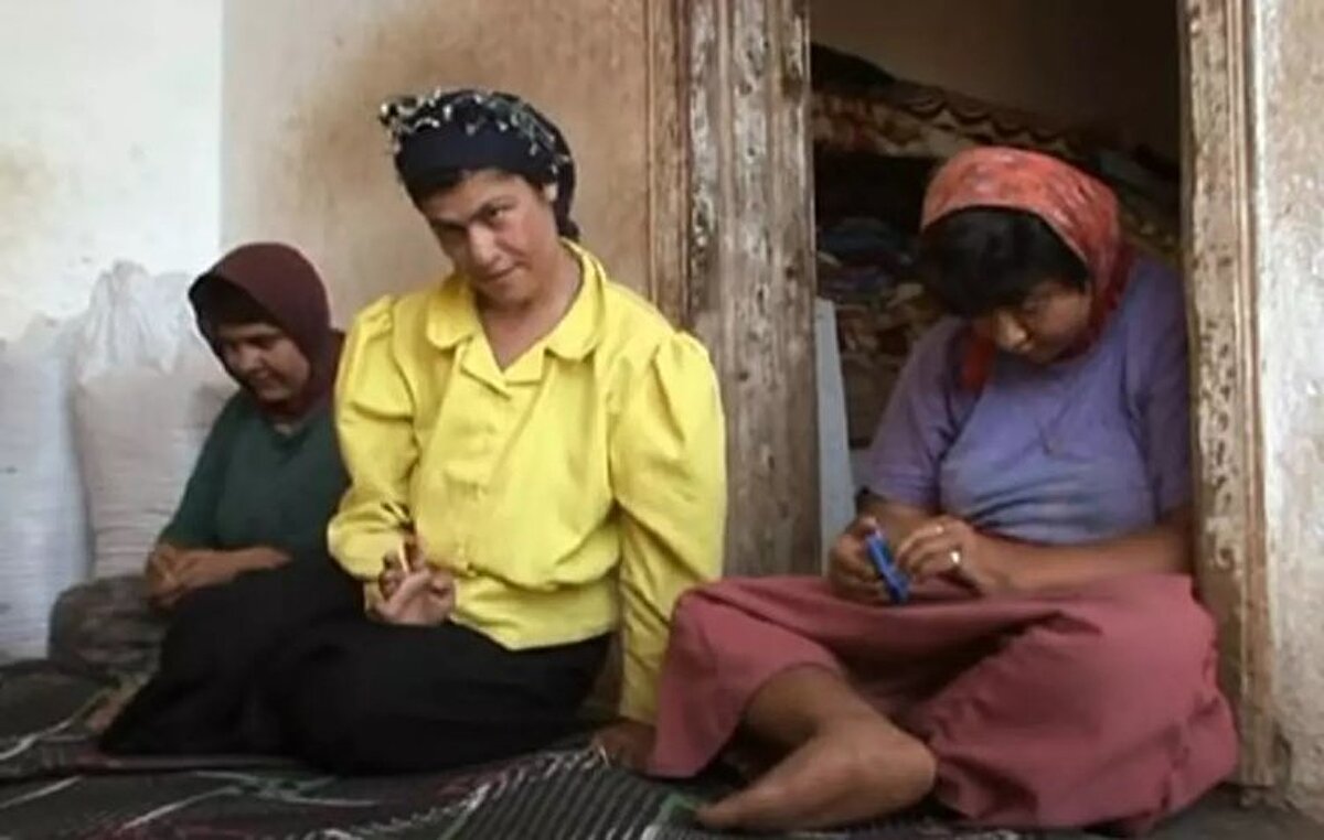 "Bunlardan birincisi atalarımız gibi iki el iki ayak üzerinde gergin bacaklarla yürüme. İkincisi primitif konuşma (konuşma gelişiminin başlangıcı), üçüncüsü de primitif zekâ (zekâ gelişiminin başlangıcı). Bir sendromun, sendrom olması için bir defa görmek yeterli değil. Birçok yerde bulunması gerekir. Ben şimdiye kadar 7 aile buldum."<br><br>