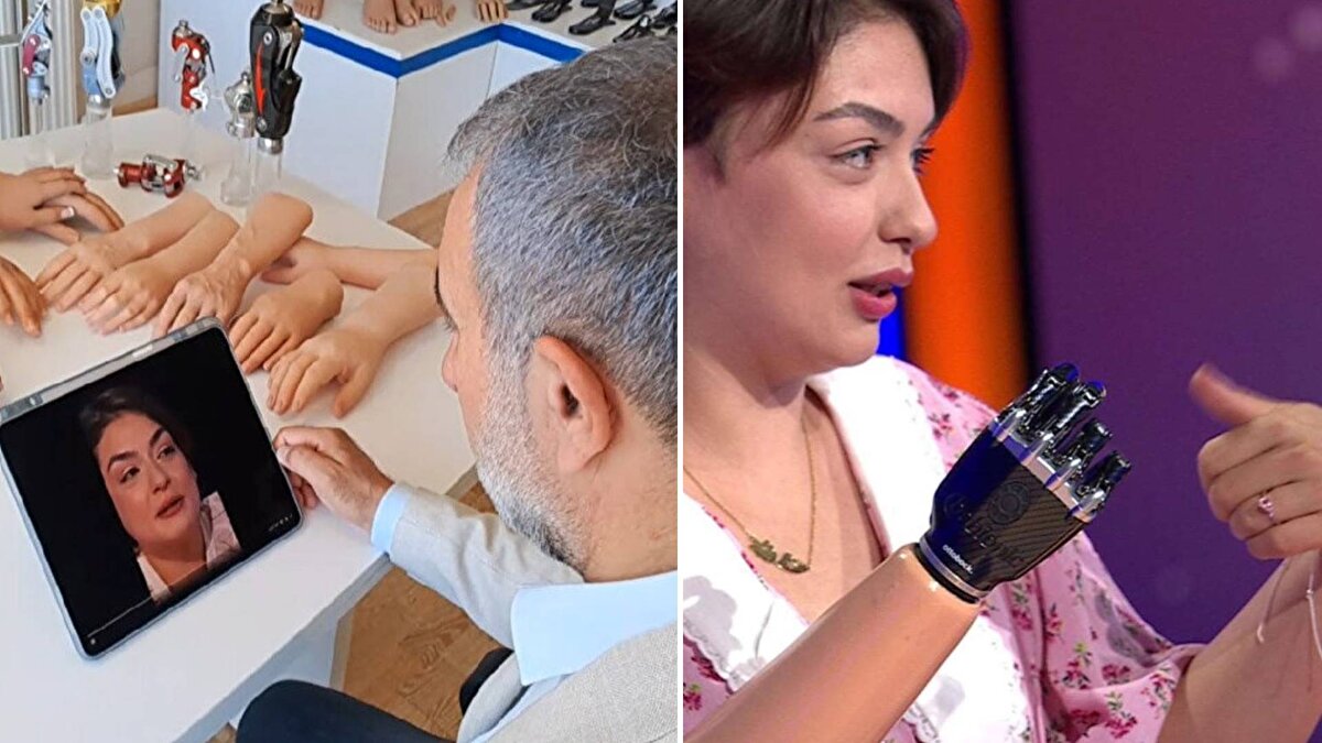 Ankara'da yaşayan Rabia Birsen Göğercin, geçen yıl Kurban Bayramı'nda esnaf babasına yardım ederken kolunu kıyma çekme makinesine kaptırdı.