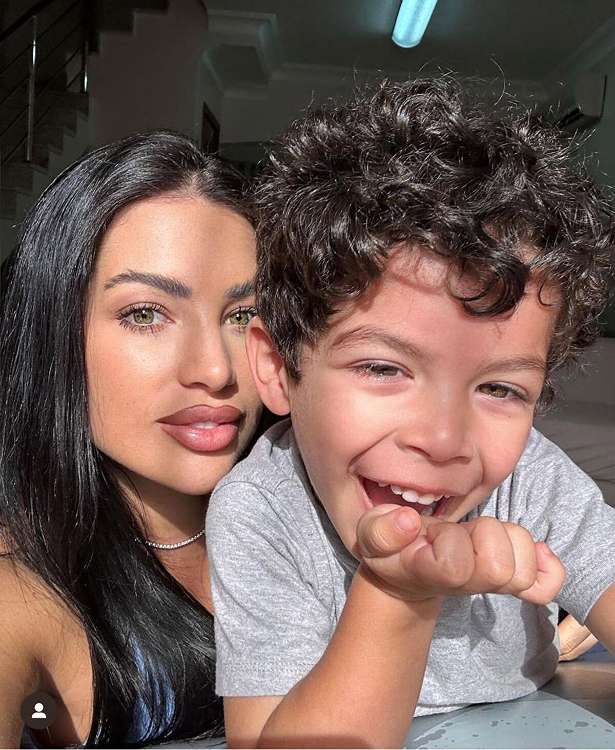 Akdeniz Üniversitesi Hastanesi'nde ameliyat edilen ve 40 gündür yoğun bakımda tedavisi süren Davi, bugün saat 11.00 sıralarında yaşamını yitirdi.